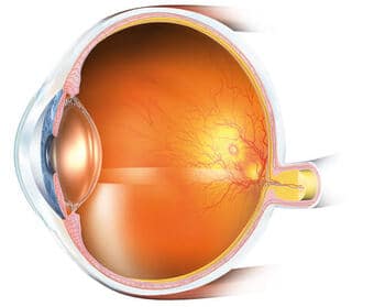 Ocular Hypertension Vs Glaucoma eye disease